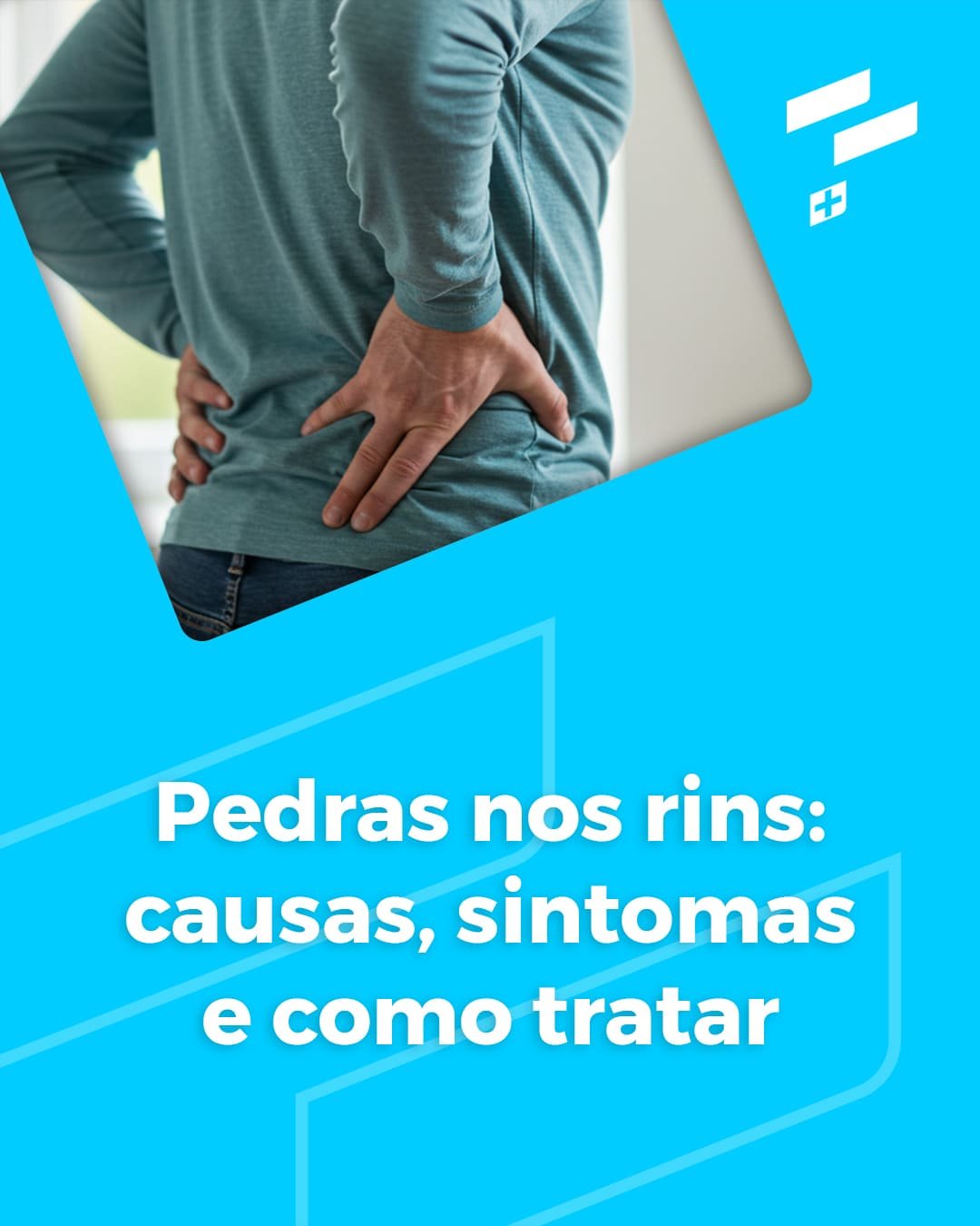 Pedras nos rins: causas, sintomas e como tratar