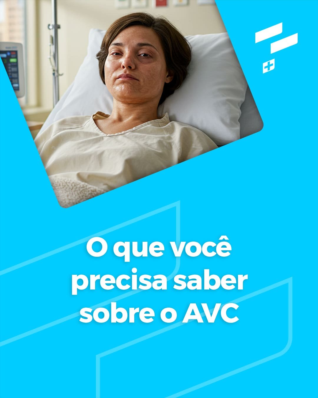 O que você precisa saber sobre o AVC