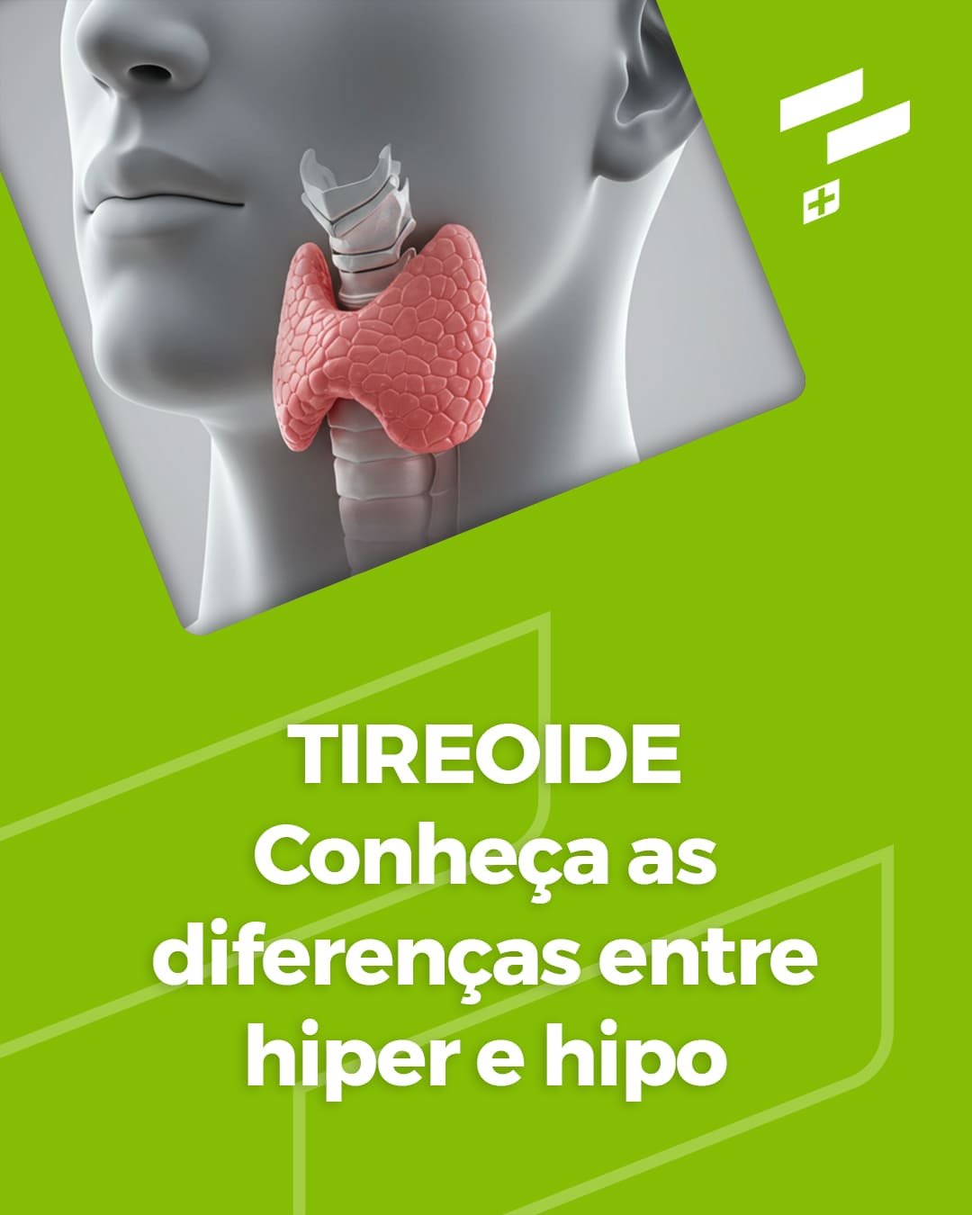 Tireoide: Conheça as diferenças entre hiper e hipo