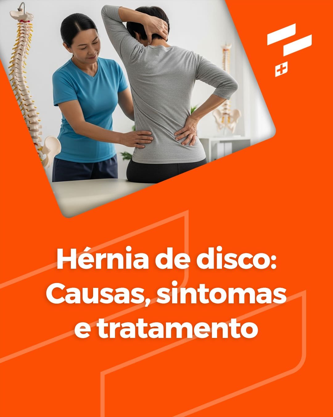Hérnia de disco: Causas, sintomas e tratamento