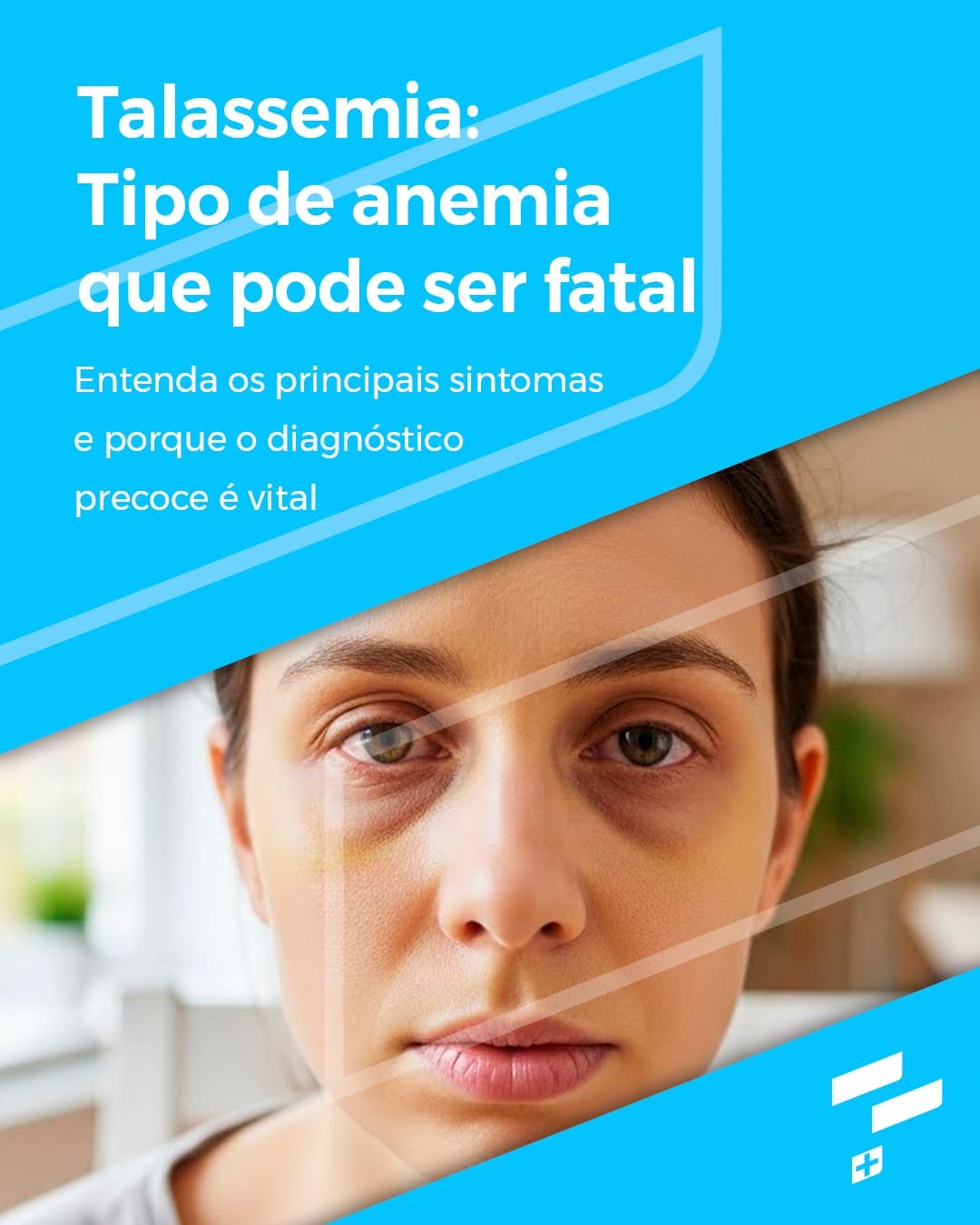 Inicio 79 Talassemia: um tipo de anemia que pode ser fatal