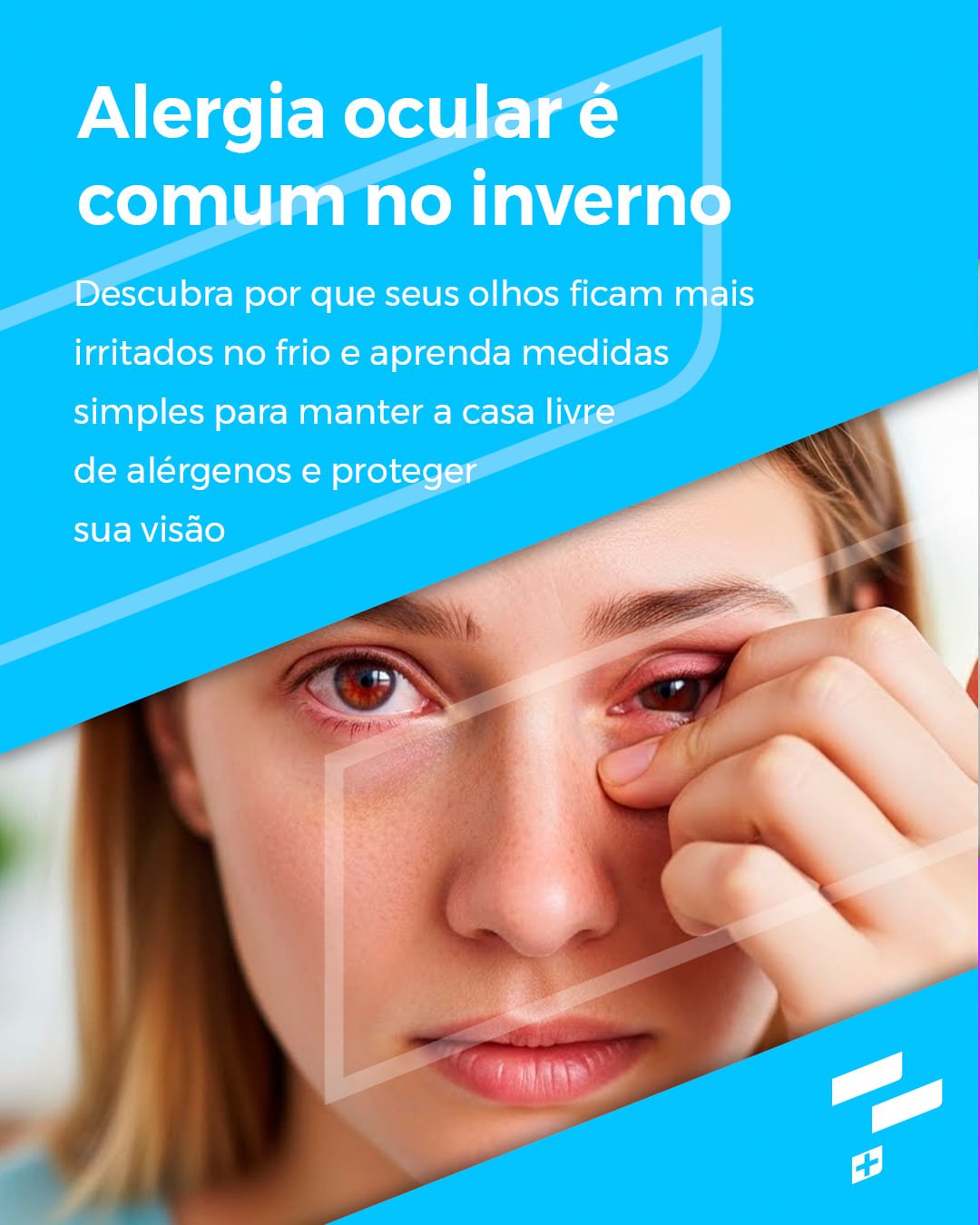 Alergia ocular é um problema comum no inverno