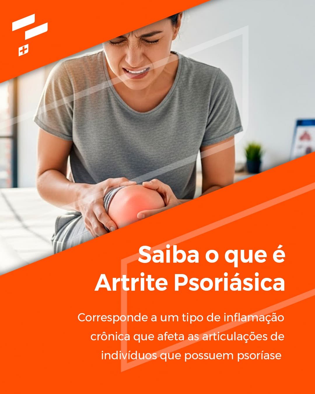 Inicio 79 Saiba o que é Artrite Psoriásica