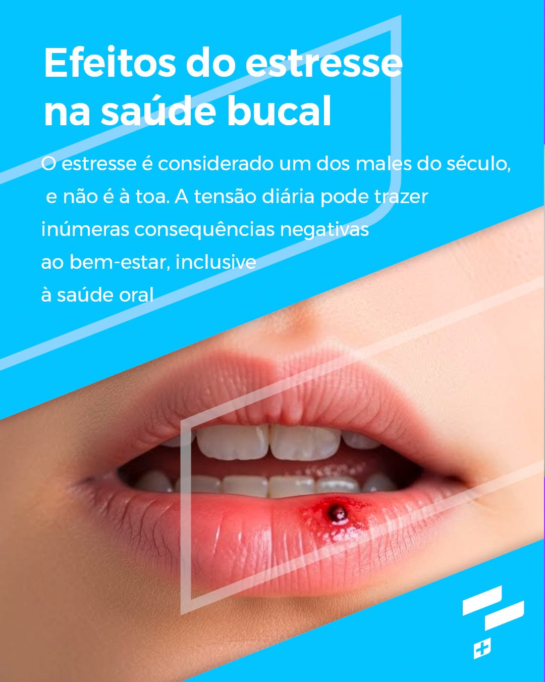 Efeitos do estresse na saúde bucal